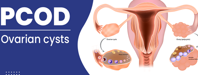 pcos pcod treatment in near me marine line